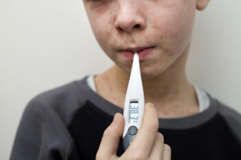 Portrait of sick sad boy child with thermometer having fever suffering from measles or chicken pox with bumps all over face. Contagious child diseases and treatment.